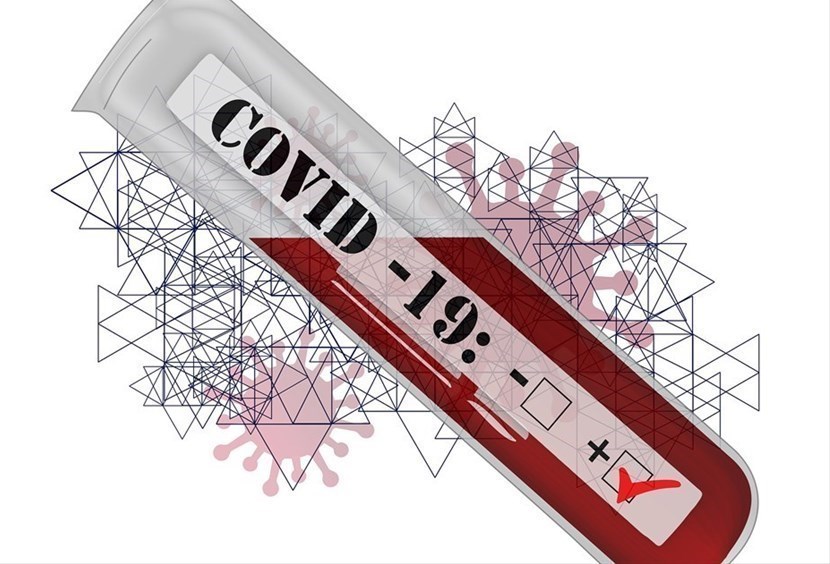 Test rapido Covid-19